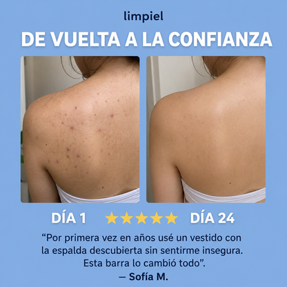 limpiel | Barra Antiacné