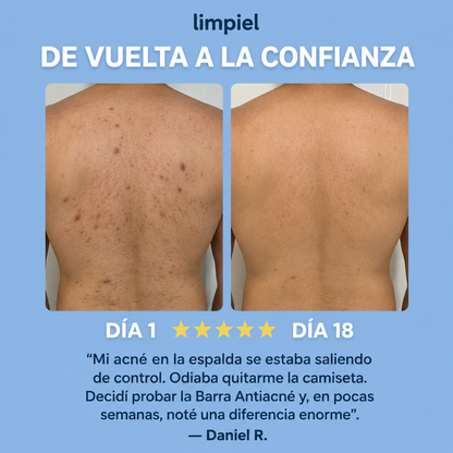 limpiel | Barra Antiacné