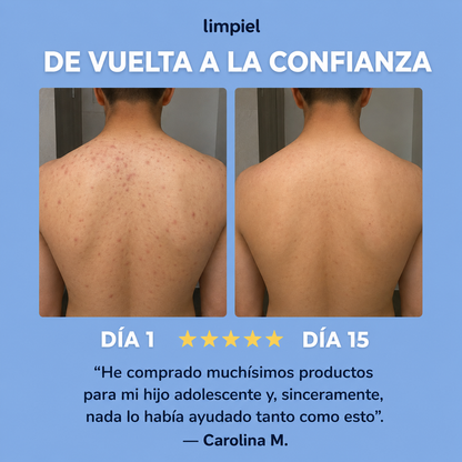 limpiel | Barra Antiacné